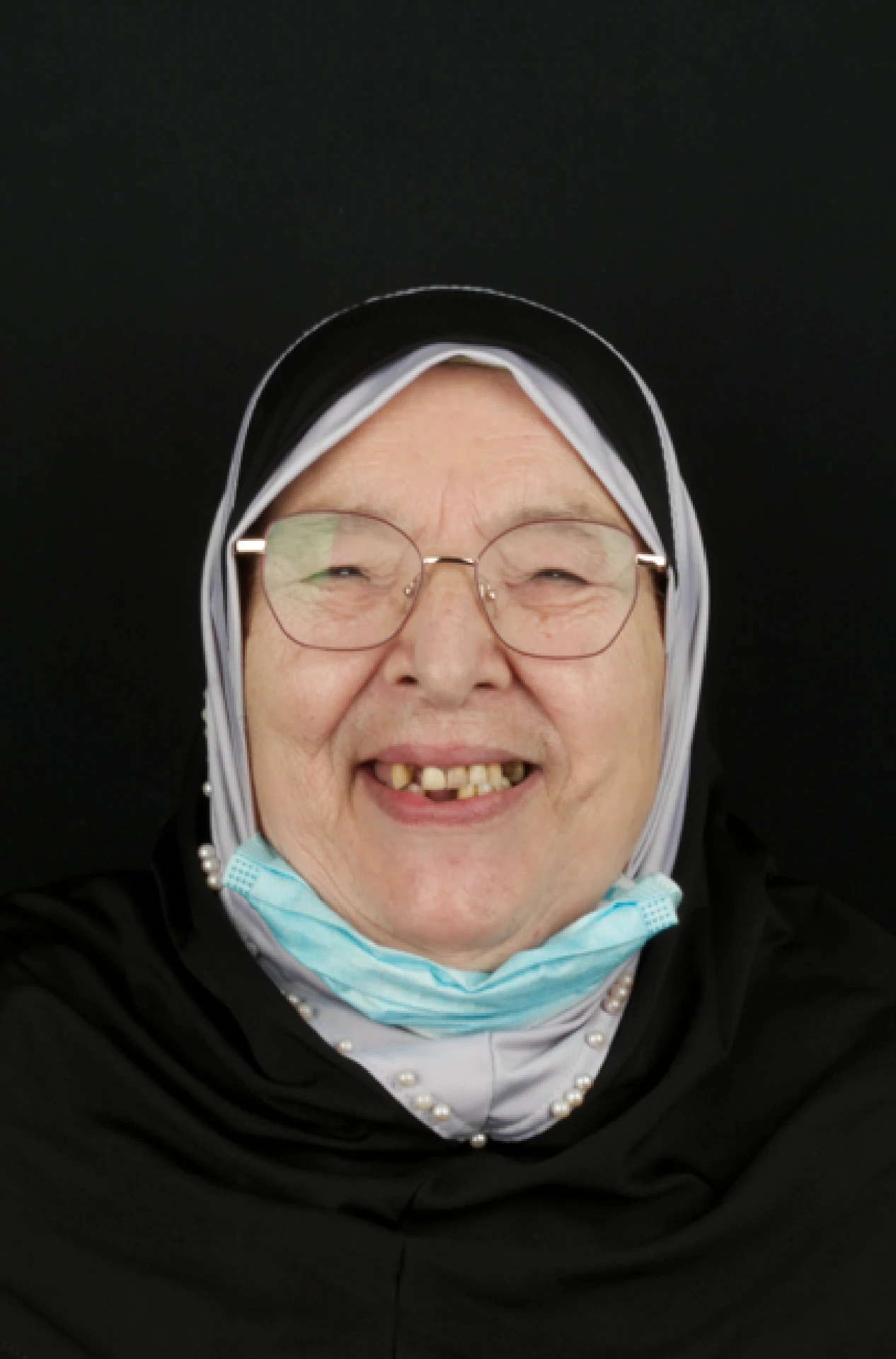 Restauration du sourire d’une patiente, avant